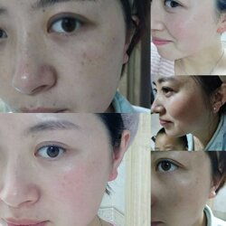 汽车疤痕修复多少钱 汽车疤痕修复多少钱