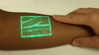 护士抽血找不到血管连续扎针