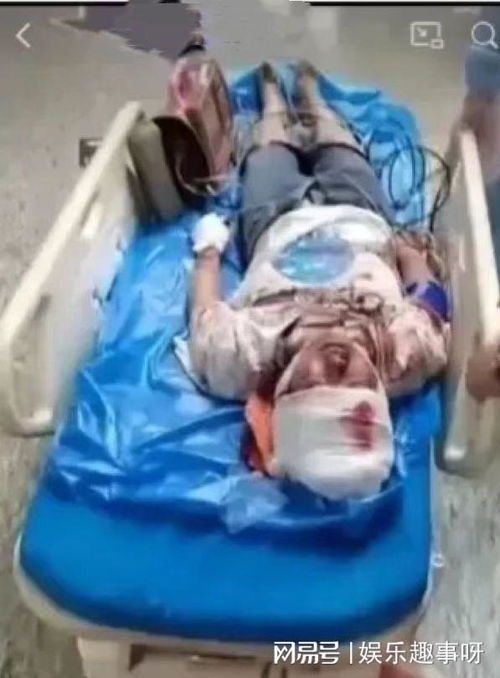 女子疑因被拔错牙坠楼身亡