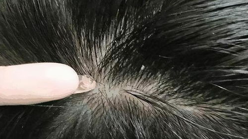 为啥头皮上总会抠出来小颗粒