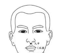 过敏不是矫情是身体在喊救命