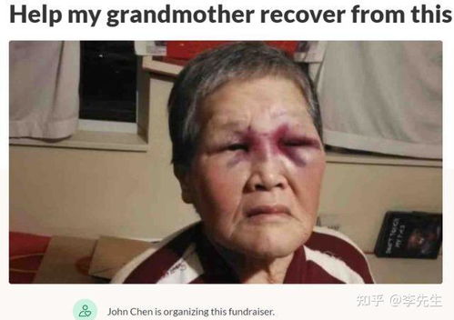 华人钢铁大王被绑撕票:颈部有勒痕