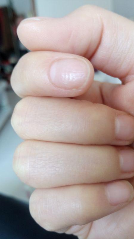 汽车指甲盖凹陷修多少钱(汽车指甲盖凹陷修复费用解析)