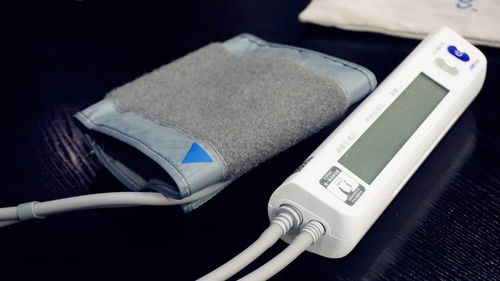 华为电脑怎么接网关线的(华为电脑如何接网关线—详细操作指南)