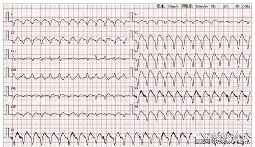 华为电脑怎么这么慢关机(华为电脑关机速度缓慢的原因分析)