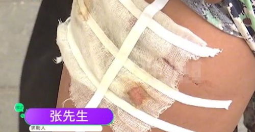 华为手机怎么大腿小腿